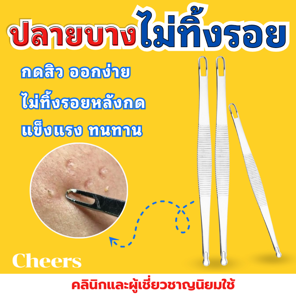 ที่กดสิว ไม้กดสิว อุปกรณ์กดสิว กดง่ายไม่ทิ้งรอย สแตนเลสแท้ 100%