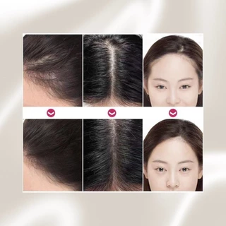 ที่ทาไรผม ผงแฮร์ไลน์ แป้งเงาผมม แป้งฝุ่นปิดเหม่ง ปิดหัวเถิก