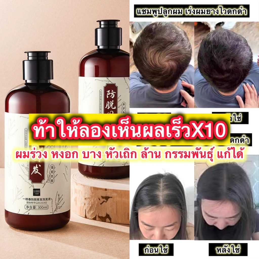 แชมพูสมุนไพรสูตรลดผมร่วง ขจัดรังแคแชมพู 1ขวด ขนาด 300ml พร้มส่ง