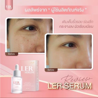 เลอเซรั่ม LER เลอซูรี่ พี่เอศุภชัย เซรั่มพลัส บำรุงผิวหน้า ลดสิว ฝ้า กระ จุดด่างดำ 30ml.
