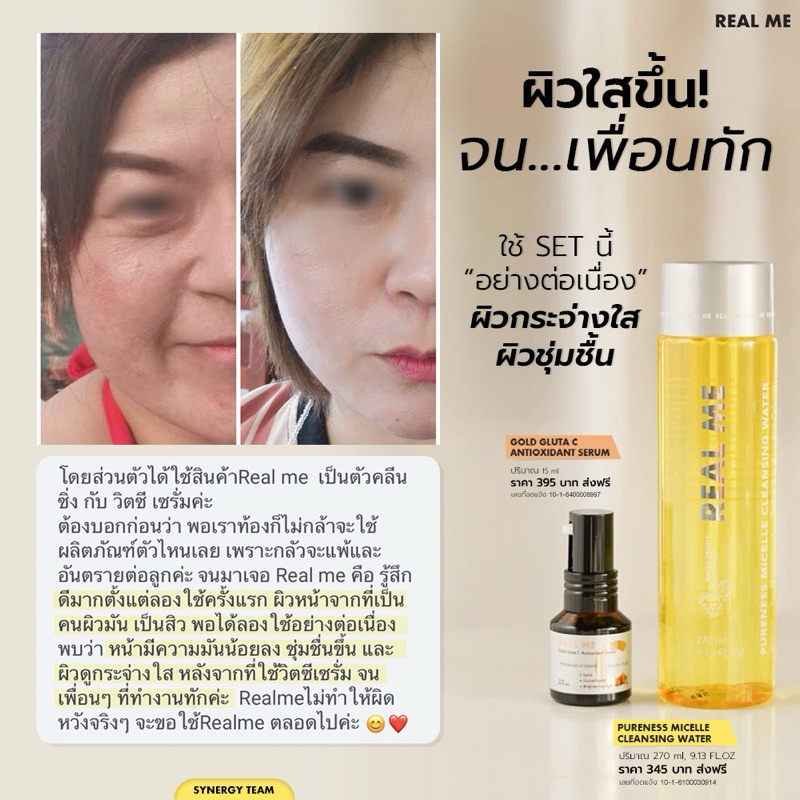 ร้านคุณน้อง โปร2ขวด วิตซีเรียลมี VitC Gold Gluta C เพื่อผิวกระจ่างใสราคาประหยัด - รูปที่ 4