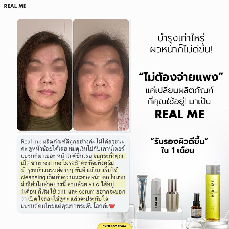 ร้านคุณน้อง โปร2ขวด วิตซีเรียลมี VitC Gold Gluta C เพื่อผิวกระจ่างใสราคาประหยัด - รูปที่ 5