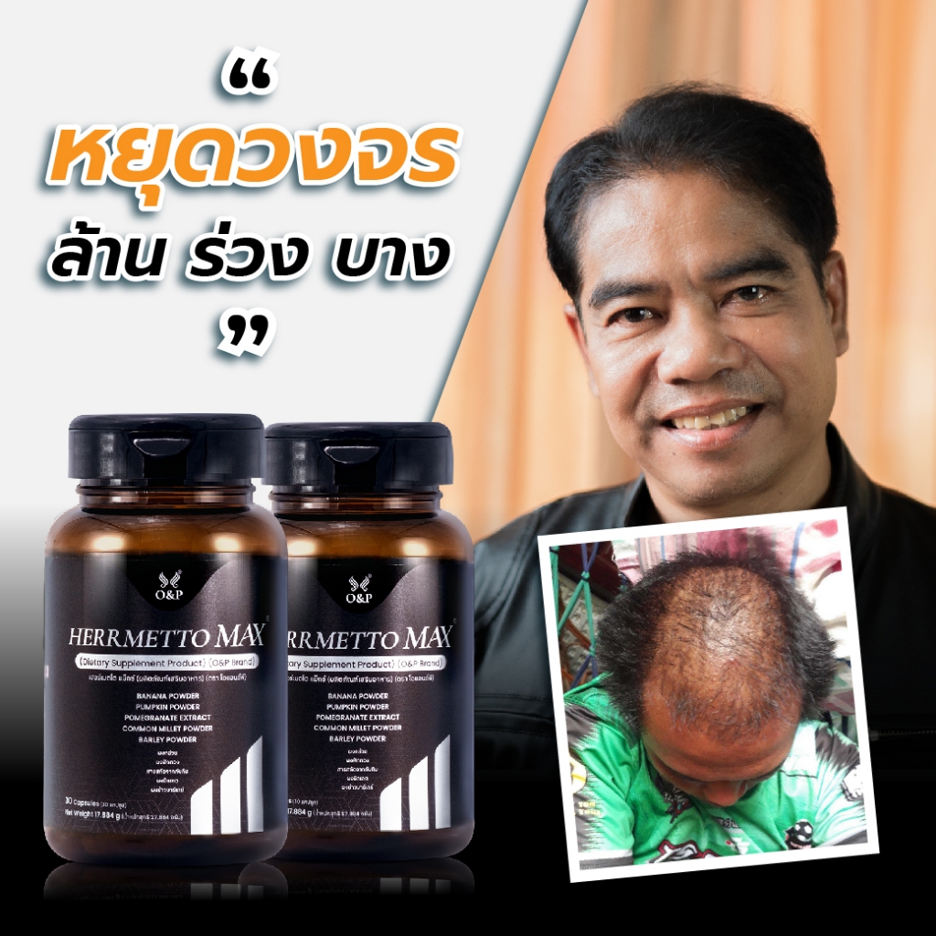 HERRMETTO Max (เฮอร์เมตโต แม็กซ์) ฟื้นฟูเส้นผม เพื่อแก้ปัญหาผมร่วงหนักให้ดกหนาแข็งแรง ขนาด 60 แคปซูล