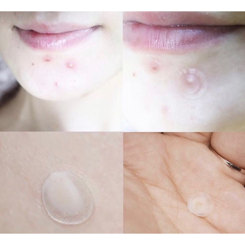 แท้ พร้อมส่งแผ่นแปะสิว Olive Young Acne care Plus spot รูปที่ 4