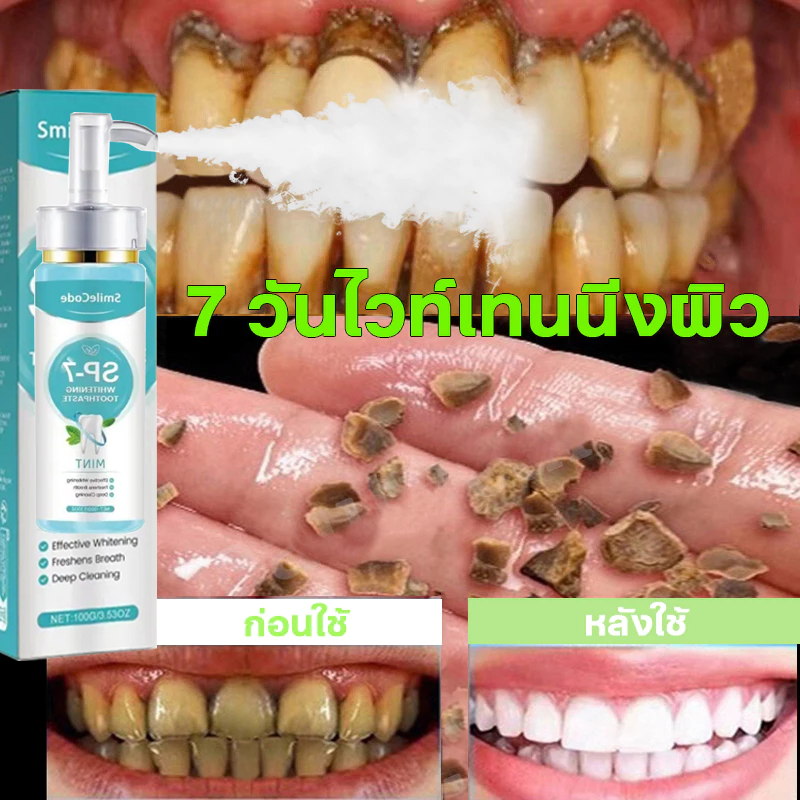 Whitening toothpasteคราบกาแฟ ฟันเหลือง ปากเหม็น ฟันขาวยาสีฟัน ลดกลิ่นปาก ยาสีฟันแก้ปวด ขัดฟันขาว ยาสีฟันหินปูน คราบหินปู