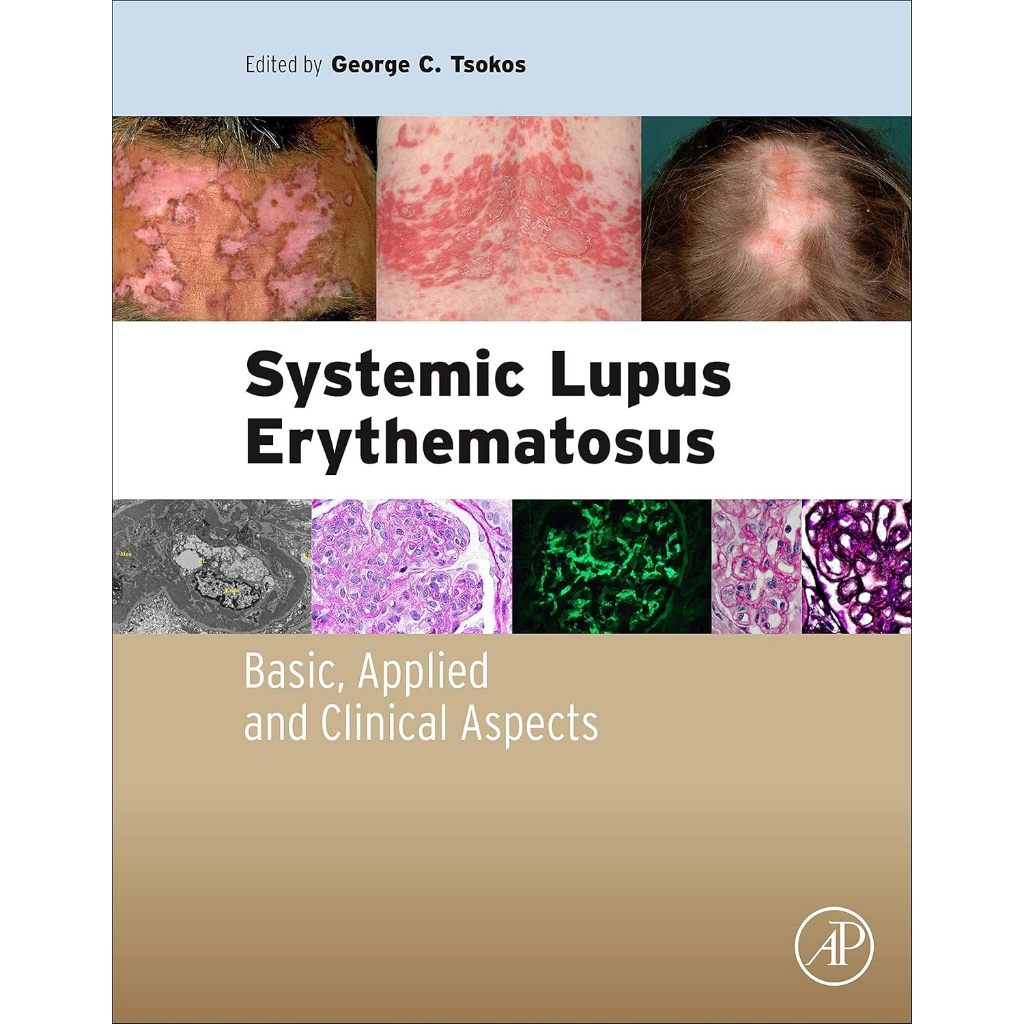 หนังสือ Systemic Lupus Erythematosus โรคแพ้ภูมิตัวเอง ลูปัส วิทยารูมาติก อายุรศาสตร์ sle rheumatolog