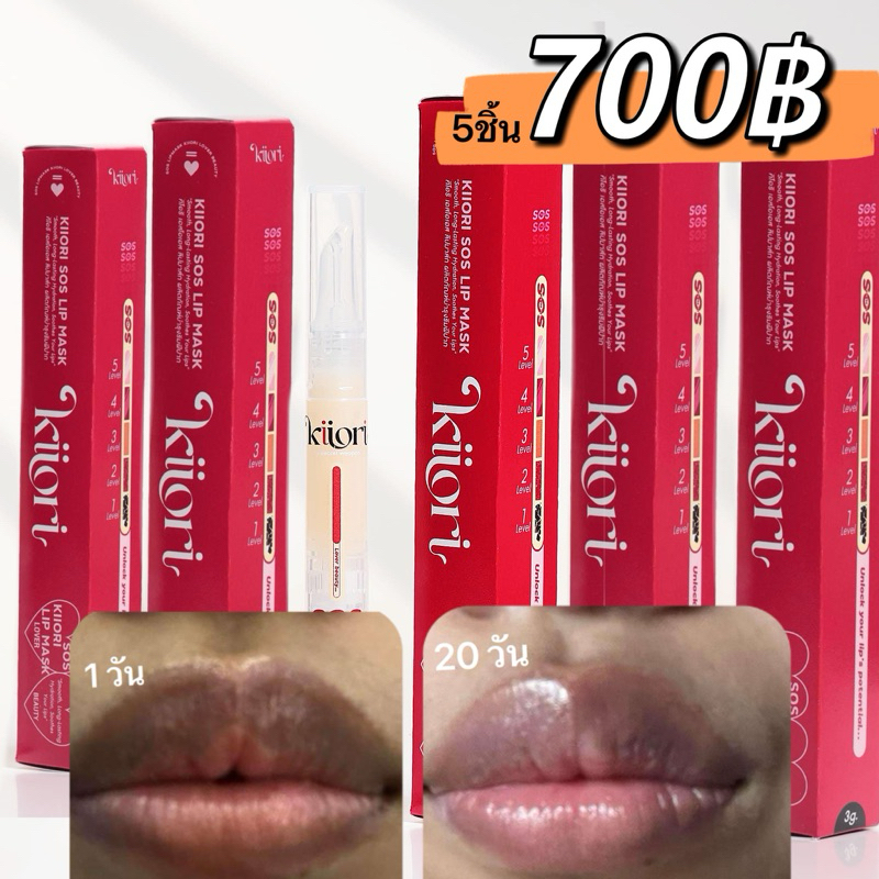 Kiiori SOS Lip Mask 5 แท่ง เพียง 700 บาท คุ้มสุด! คิโอริ เอสโอเอส ลิปมาส์ก บำรุงริมฝีปาก ปากแห้ง ปาก