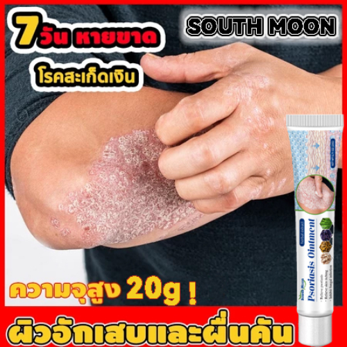 🔥ส่งไวจากไทย🔥ครีมบำรุงผิว 20g รอยแดง โรคผิวหนัง เกลื้อน กลาก คัน