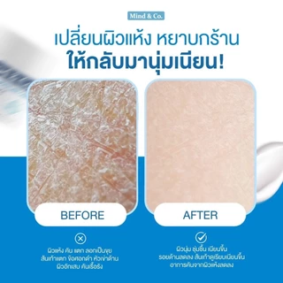 พร้อมส่ง ส่งไว (เช็ตคู่ 2 กป) Mind & Co. Soothing Cream ครีมแก้ปัญหา ผิวเสีย ผิวแห้ง มือแห้ง มือลอก ส้นเท้าแตก
