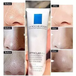 มอยส์สำหรับคนเป็นสิว La Roche Posay Cicaplast Baume B5+ 💕 DUO+M💗K+