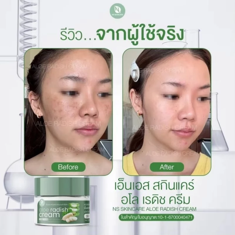 เอ็นเอส สกินแคร์อโลเรดิชครีมตอบโจทย์มุกปัญหาของใบหน้า thumbnail 4