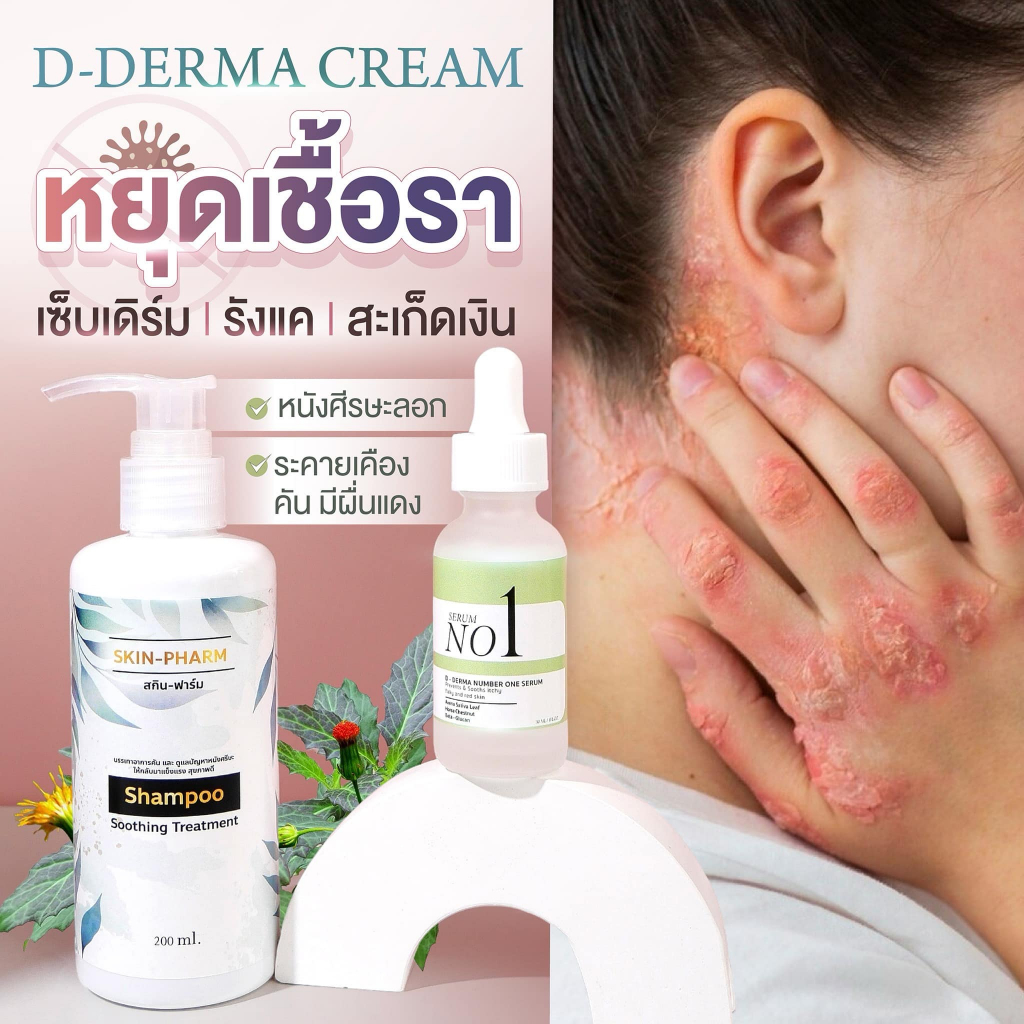 (ของแท้) เซ็ทแชมพูและเซรั่ม สำหรับรังแค หนังศีรษะลอก แผล ศีรษะอักเสบ เซ็บเดิร์ม ต่อมไขมันอักเสบ