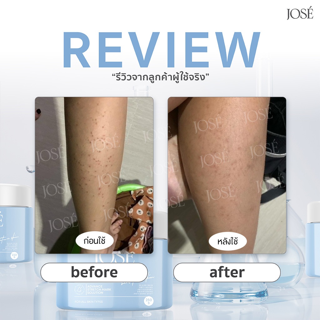 [ในไลฟ์สดส่วนลด 50%] JOSE White Plus Body Cream ครีมโจเซ่ ไวท์พลัส บำรุงผิวกาย ขนาด 250 กรัม (แพ็กเกจใหม่) รูปที่ 6