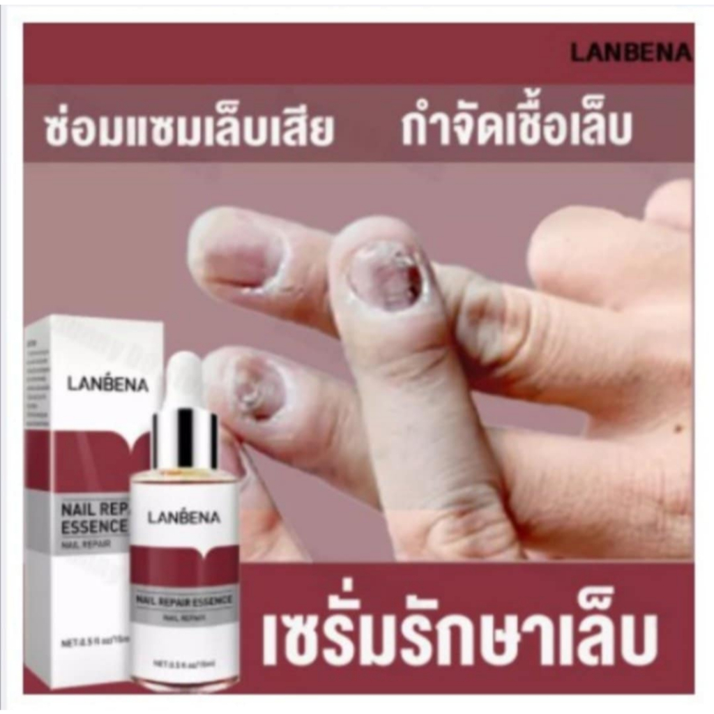 LANBENA เซรั่มบำรุงเล็บ เล็บขบ เชื้อรา ซ่อมแซมเล็บแตก 15 ml. (แถมฟรี!! ตะไบเล็บ)