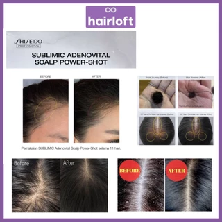 แท้100%ฉลากไทย ชิเซโด้ เซรั่มเข้มข้น รักษาผมร่วง Shiseido Sublimic Adenovital Scalp Power Shot Adenovital shampoo