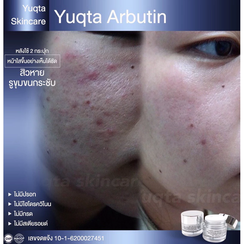 Alpha Abutin Cream__30g (ยุกตา สกินแคร์) thumbnail 10