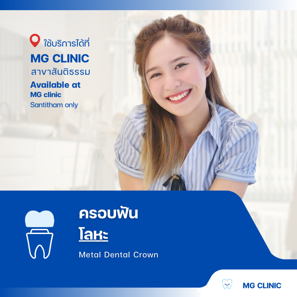 โปรแกรมครอบฟันโลหะ (Metal Dental Crown) - MG Dental Clinic