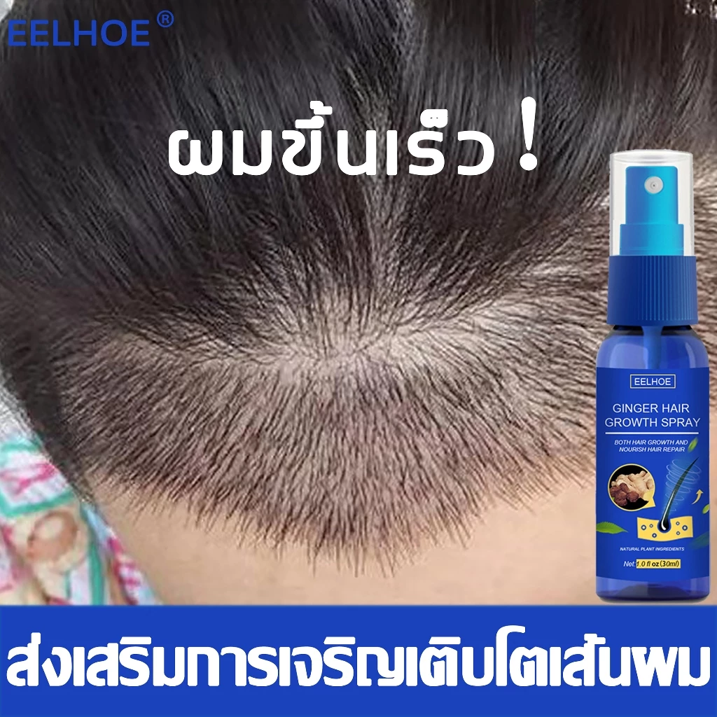 บอกลาหัวล้าน EELHOE สเปรย์ปลูกผม ยาปลูกผม เร่งผมขึ้นใหม่ เร่งผมยาวไว ป้องกันผมร่วง น้ำยาปลูกผม