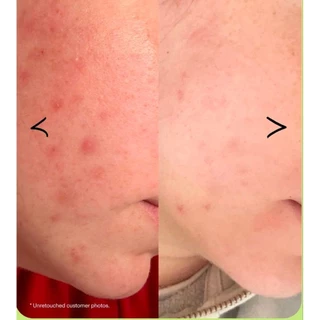 (โคัดลด 25%+ลด1059-18/8 ล็อตอเมริกา) Krave​ Beauty​ Matcha​ Cleanser​ 120 ml