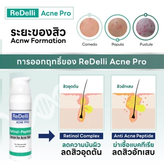 ReDelli Acne Pro รีเดลลี่ แอคเน่ โปร เซรั่มลดสิว สิว รักษาสิว Retinol + Peptide เรตินอล