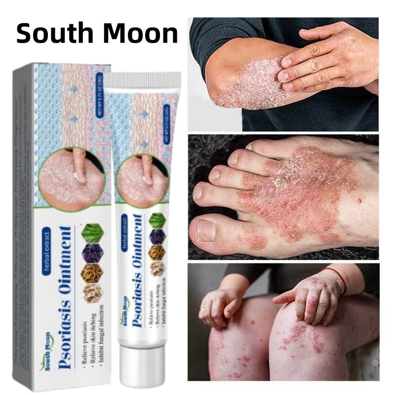 【ซื้อ 1 แถม 1】ครีมลดอาการคัน ทาแก้คัน ผิวหนังทากากเกลื้อน สารสกัดจากพืชใช้ได้ทั้งตัวบอกลาผิวคันได้ง่ายๆ