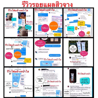 โฟมล้างหน้า 90g 2 ชิ้น DERRATU 🔷ลดสิวอุดตัน🔶ลดสิวหน้าใส ลดมัน ลดแผลสิว หลุมสิวตื้น รูขุมขนกระชับ