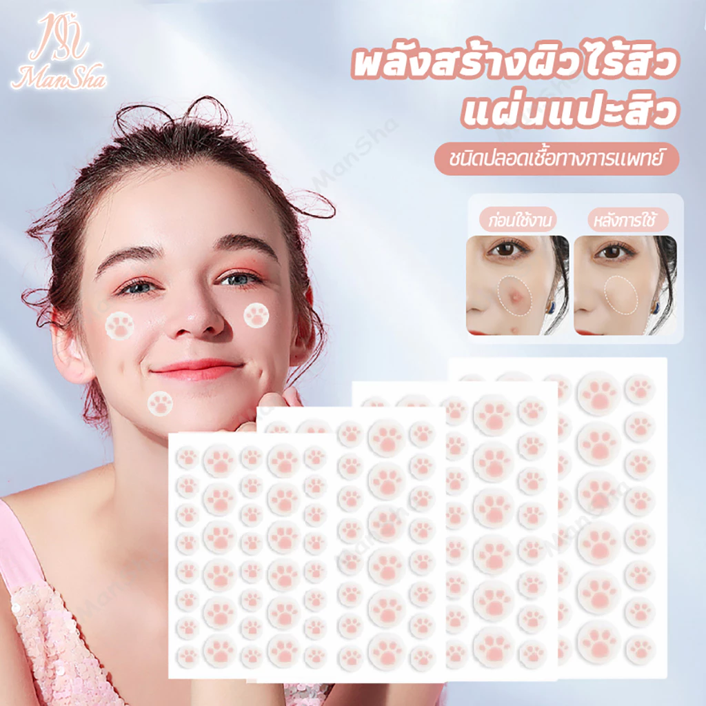 แผ่นสติกเกอร์แปะสิว แผ่นแปะดูดสิว แผ่นดูดสิว น่ารักแผ่นแปะสิว น่ารักแผ่นสิว สําหรับติดตกแต่งสิว