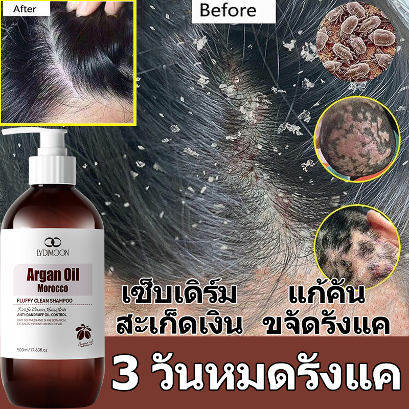 ยาสระผมขจัดรังแค แชมพูขจัดรังแค ยาสระผม แชมพูลดผมร่วง 500ML 5Xกรดมะนาว ขจัดรังแค แก้คัน ลดผมร่วง บํารุงรากผม shampoo