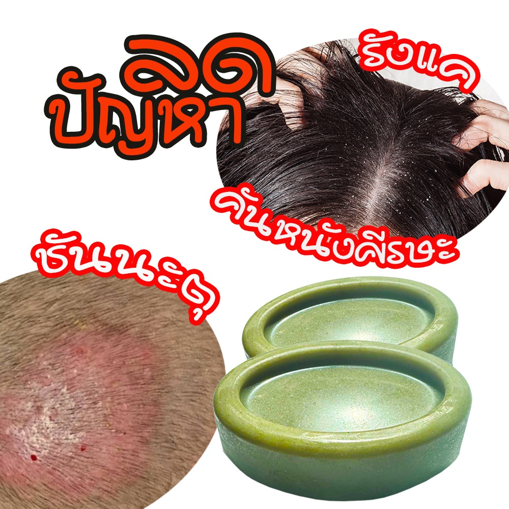 รีบบหยุดทรมานกำจัดชันนะตุ อาการคันหนังศรีษะ ศรีษะแห้งลอกแสบ