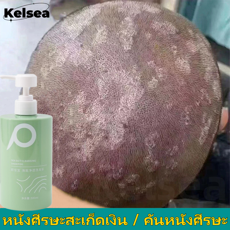 【พร้อมส่งจากไทยทันที】แชมพูขจัดรังแค 500g เกลือทะเลแชมพูลดอาการคันและหนังศีรษะยาสระผมขจัดรังแครังแค ยาสระผมแชมพู