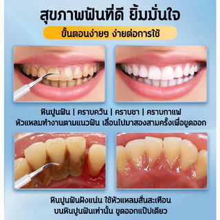 HYUNDAI เครื่องขูดหินปูน ที่ขูดหินปูน ขูดหินปูนเอง ไม่เจ็บเหงือก ขจัดหินปูนฟัน+แปรงฟัน tooth scaler