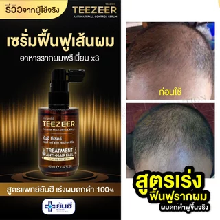 YANHEE TEEZEER SERUM ยันฮี ทีเซอร์ เซรั่ม บำรุงเส้นผมแข็งแรง เพิ่มการงอกใหม่ ผม หนา บาง 3 กล่อง