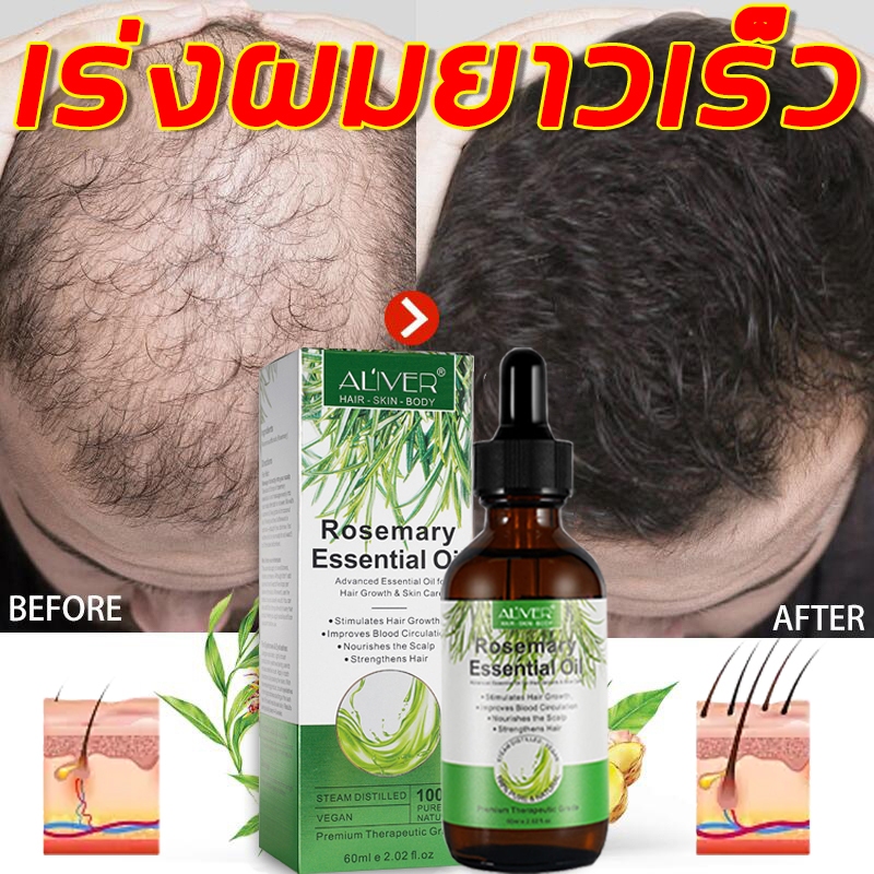 ขายดีสุดคุ้ม Aliver เซรั่มโรสแมรี่ปลูกผม 60ml เร่งการงอกใหม่ บำรุงรากลึก ลดปัญหาผมบาง เส้นผมดูหนาเป็นธรรมชาติ
