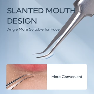 Oni Blackhead Remover Tweezers for Quick and Easy Removal of Pimples ที่กดสิว ชุดกดสิว อุปกรณ์กดสิว กำจัดสิวเสี้ยน
