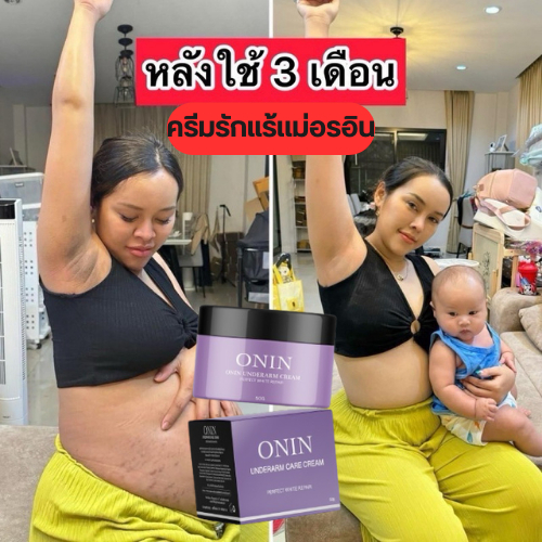 [ ของแท้/ร้านบริษัท ] ครีมรักแร้อรอิน onin แม่อรอิน ลดรอยแตกลาย หนังไก่เป็นตุ่ม รักแร้ขาว รักแร้ ครีมรักแร้ 50g.