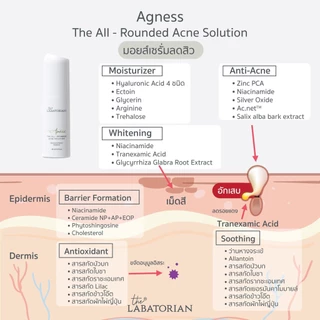 THE LABATORIAN AGNESS THE ALL-ROUNDED ACNE SOLUTION