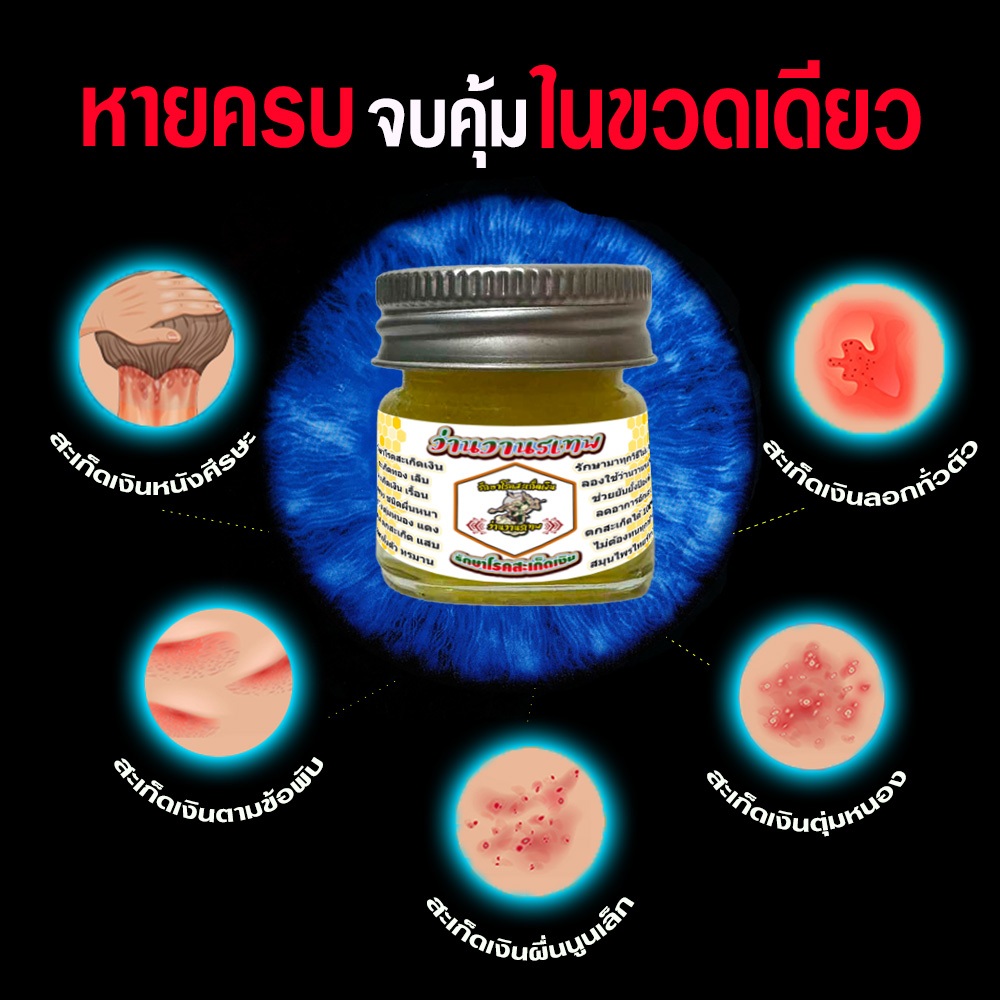 ปราบ สะเก็ดเงิน เรื้อนกวาง ตัวช่วยกำจัดแก้ สะเก็ดเงิน เรื้อนกวาง ให้คุณหมดกังวลปัญหาขัดลอกผิวหน้ามือเท้า