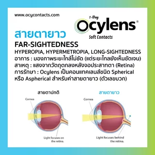 Ocylens สายตายาว โปร 2 กล่อง 60 คอนแทคเลนส์ รายวัน ชนิดใส