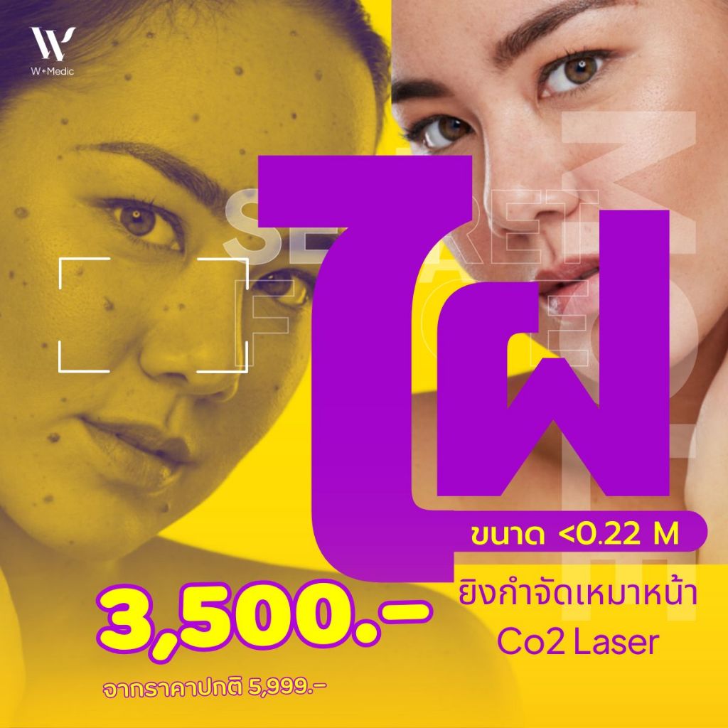 CO2 Laser จี้ไฝ จี้ขี้แมลงวัน จี้สิวหิน ไม่จำกัดจำนวนเม็ด หน้า หรือ คอ