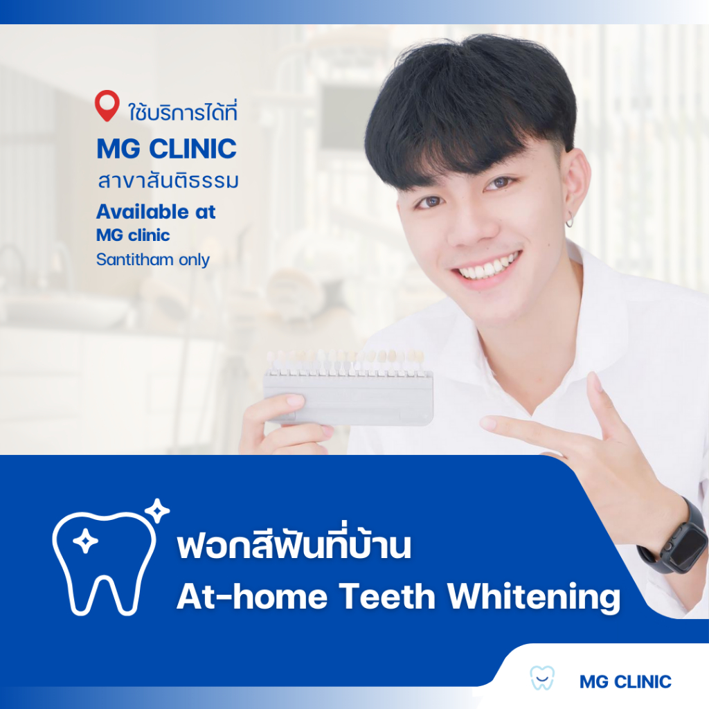 โปรแกรมฟอกสีฟันที่บ้าน (At-home Teeth Whitening) - MG Dental Clinic
