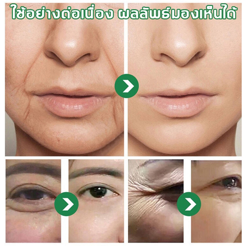 กระชับ/ยกกระชับ เซรั่มหน้าใส ครีมต่อต้านริ้วรอย รอยตีนกา ริ้วรอยหน้าผาก เผยผิวหน้าที่ ครีมต่อต้านริ้วรอย ยกกระชับใบ ราคา ถูกที่สุด ดีลบีเคเค แกลเลอรีภาพที่ 7