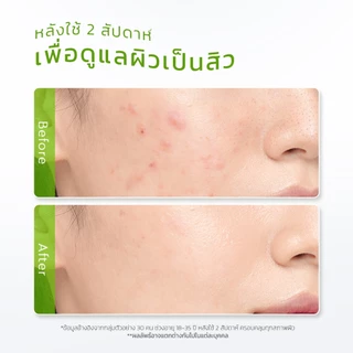 Glad2Glow Centella Gel Moisturizer (ครีมมอยเจอไรเซอร์สำหรับผิวหน้า) ความชุ่มชื้น ใบหน้า เจล Skincare 100กรัม