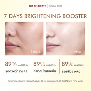 The Originote Retinol B3 เรตินอล เซรั่ม เพื่อลดเลือนริ้วรอย ปรับสีผิวที่ไม่สม่ำเสมอ