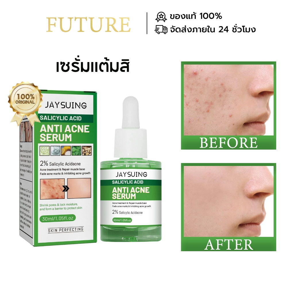 Jayusing เซรั่มแต้มสิ เซรั่มสิว เซรั่มต่อต้านสิว Anti Acne Serum ป้องกันสิว ช่วยป้องกันปัญหาสิว