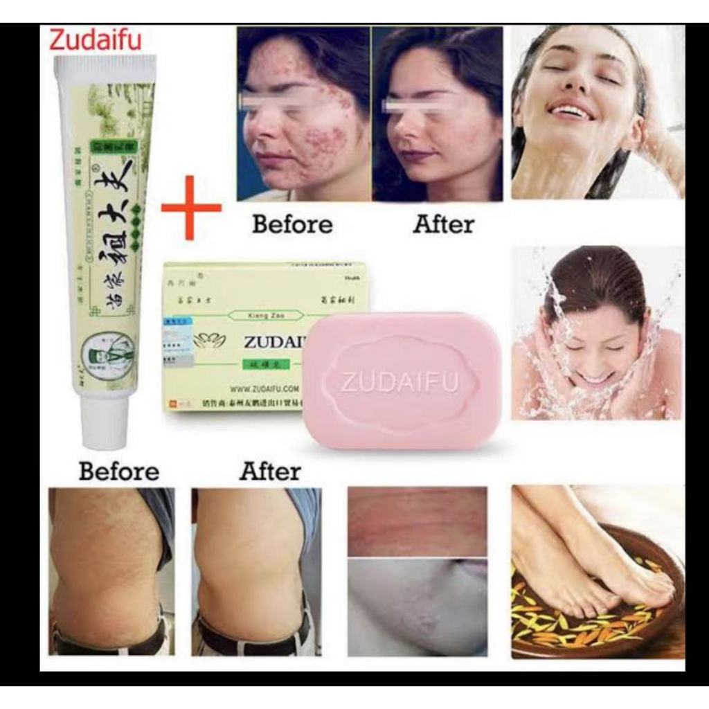 Zudaifu Sulfur Soap สบู่สมุนไพรธรรมชาติ 80 กรัม สบู่สมุนไพรบำรุงผิวหนัง สบู่กำมะถัน ​ครีมZDF เนื้อคร