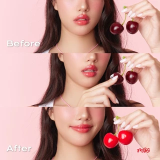 ครีมบำรุงผิวบริเวณหัวนม Cherry Nipple Treatment ครีมทาจุก ครีมทาหัวนมชมพู ช่วยปรับสีให้ชมพูสว่างกระจ่างใส | missBBgirl