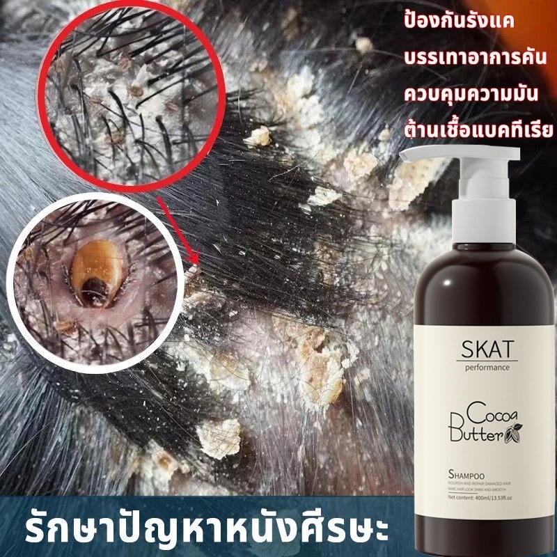 SKATคอฟฟี่ แชมพู รีเฟรช ขจัดรังแค ปุย สเปิร์ม คอนดิชันเนอร์ มอยส์เจอร์ไรเซอร์ ซอฟท์ คอนดิชันเนอร์ ปรับปรุง แฮร์มอมเนสตี้
