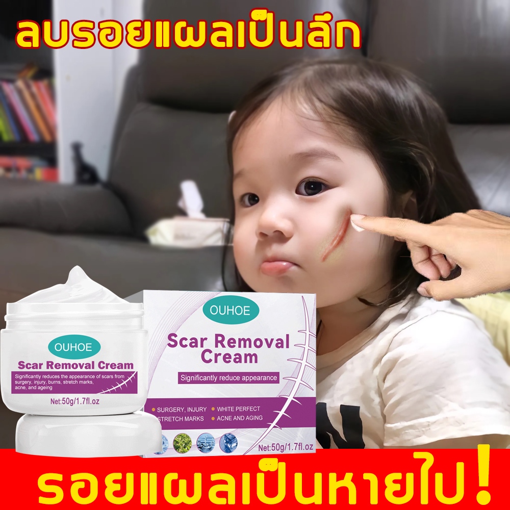 ครีมลดรอยแผลเป็น แผลเป็นผ่าตัด แผลไฟไหม้/น้ำร้อนลวก แผลเป็นนูนหนา แผลเป็นถลอก เร่งการซ่อมแซมให้ผิว