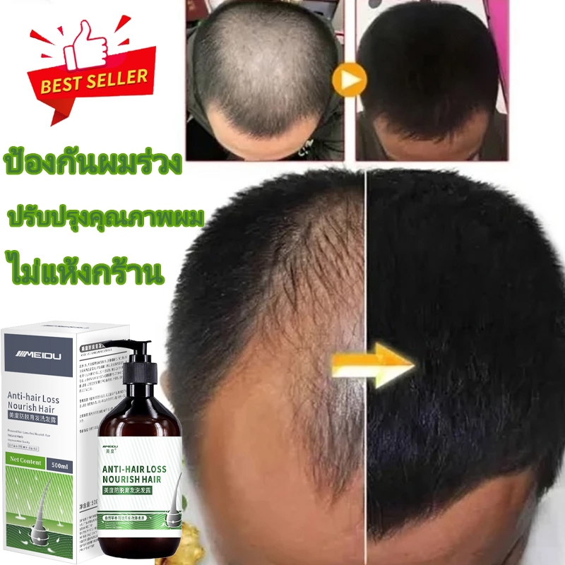 แชมพูขิง เร่งผมยาวแชมพู แฮร์โทนิค แชมพูสมุนไพร ผมร่วง แชมพูสำหรับลดผมขาดหลุดร่วง ปลูกผม ป้องกันรังแค ควบคุมความมัน500ml