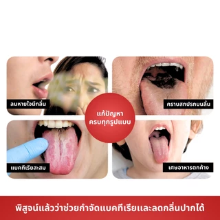 เครื่องขูดลิ้น 4 ชิ้น ที่ขูดลิ้นสแตนเลสทรง U-Shape ที่ขูดลิ้น ลดแบคทีเรียในช่องปาก แก้ปัญหาแปรงฟันไม่สะอาดปากเหม็